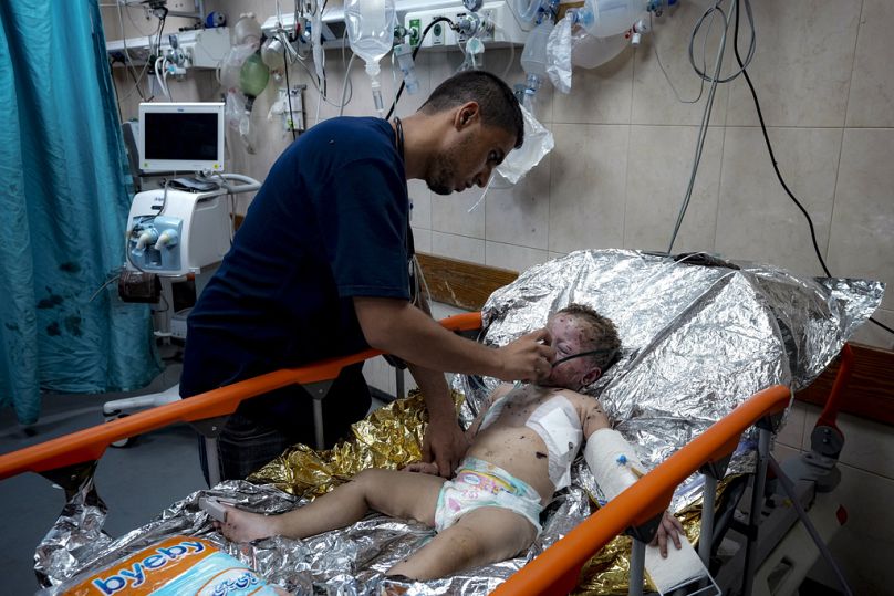 L'enfant palestinien Siwar Abdel-Hadi, 2 ans, blessé lors du bombardement israélien de la bande de Gaza, reçoit des soins médicaux dans un hôpital de Deir al-Balah, le mercredi 24 juillet 2024