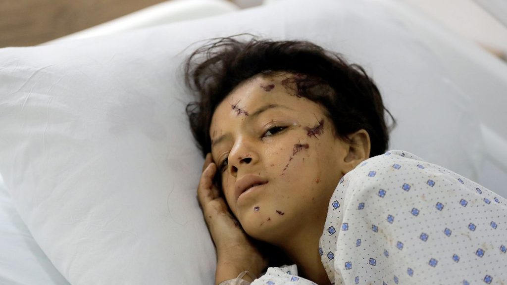 A wounded girl lies in a hospital bed in the southern village of Saksakieh, Lebanon, 25 September 2024