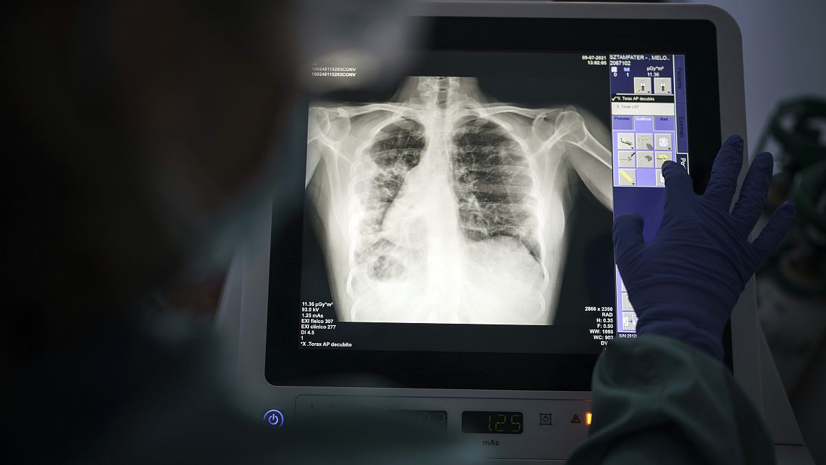 A health worker checks the x-ray of a patient in Spain.