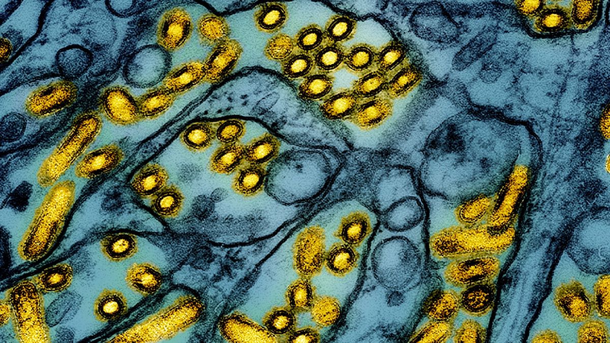 This colorised electron microscope image shows avian influenza A H5N1 virus particles (yellow).