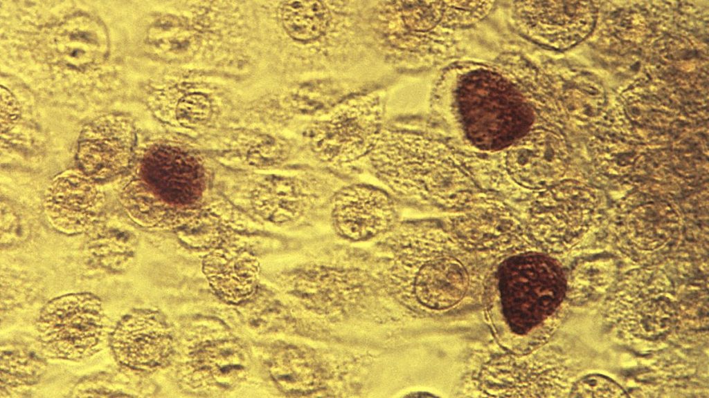 FILE - This 1975 microscope image made available by the the Centers for Disease Control and Prevention shows Chlamydia trachomatis bacteria.