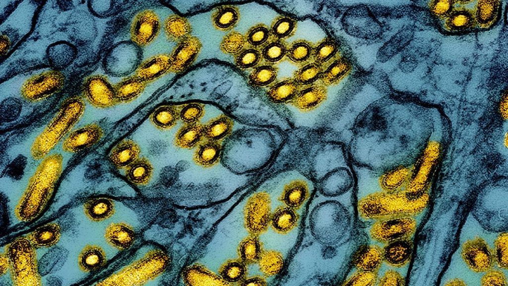 FILE -This colourized electron microscope image shows avian influenza A H5N1 virus particles (yellow), grown in Madin-Darby Canine Kidney (MDCK) epithelial cells (blue).