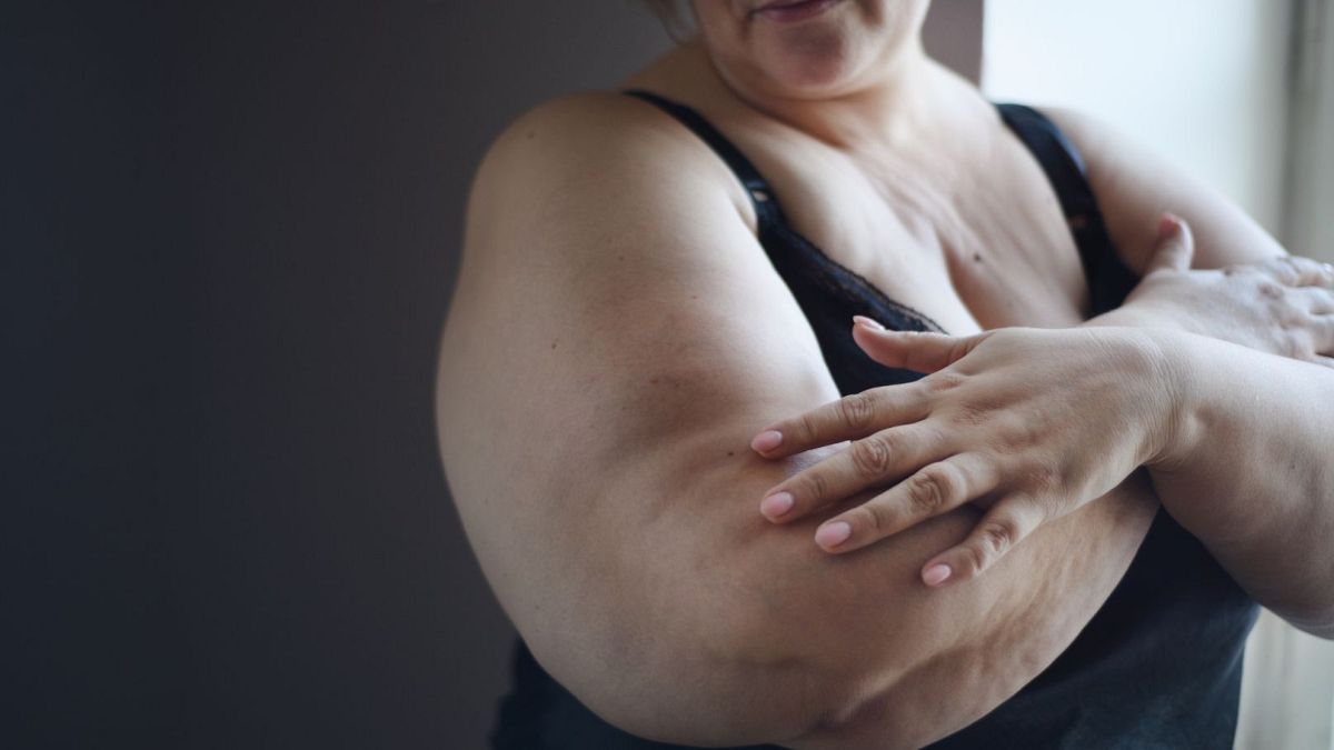 A woman with obesity stands at home.