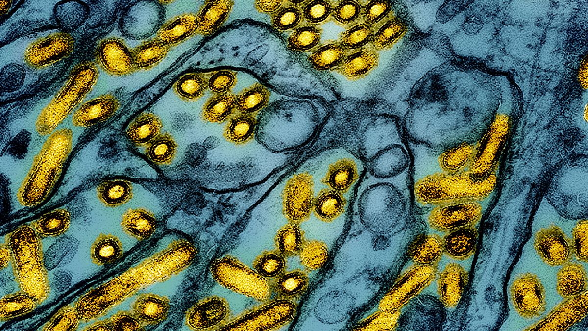 This colorized electron microscope image released by the National Institute of Allergy and Infectious Diseases on March 26, 2024, shows avian influenza A H5N1 virus particles.